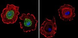 Invitrogen Estrogen Receptor alpha Monoclonal Antibody (EVG F9) 100 &mu;L;