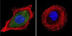 Invitrogen Estrogen Receptor alpha Monoclonal Antibody (EVG F9) 100 &mu;L;