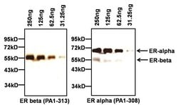 Invitrogen Estrogen Receptor beta Polyclonal Antibody 50 &mu;g; Unconjugated:Antibodies,