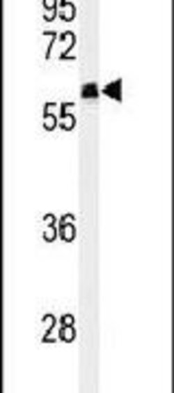 FAM20A Polyclonal Antibody, Invitrogen 400 μL; Unconjugated:Antibodies,