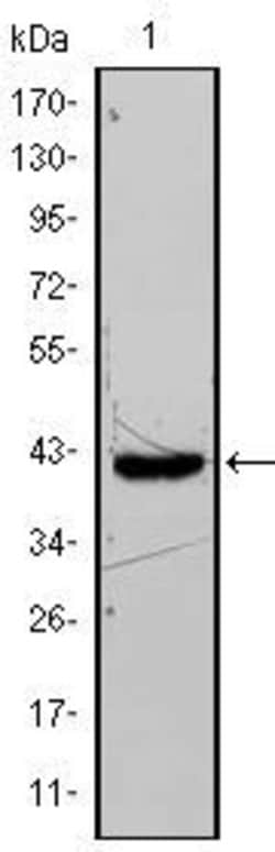 Invitrogen FABP4 Monoclonal Antibody (9B8D) 100 &mu;L; Unconjugated:Antibodies,