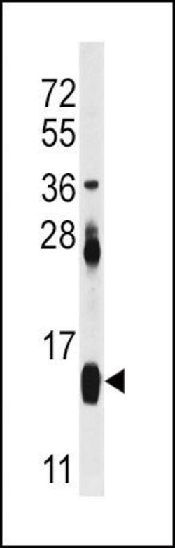 FABP4 Rabbit anti-Human, Mouse, Polyclonal, Invitrogen 400 &mu;L; Unconjugated:Antibodies,