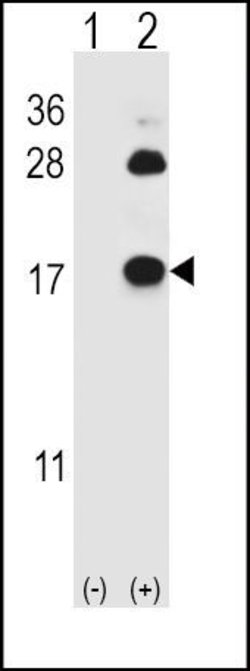 FABP4 Rabbit anti-Human, Mouse, Polyclonal, Invitrogen 400 &mu;L; Unconjugated:Antibodies,