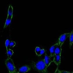 Invitrogen FAK Monoclonal Antibody (10H7) 100 &mu;L; Unconjugated:Antibodies,