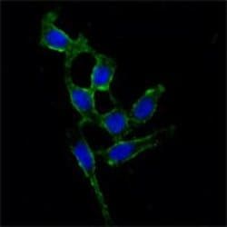 FAK Monoclonal Antibody (10H7E9):Antibodies, Monoclonal