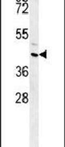 FAM26E Polyclonal Antibody, Invitrogen 400 &mu;L; Unconjugated:Antibodies,
