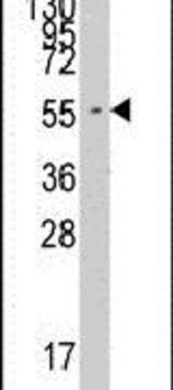 FARSA Rabbit anti-Human, Polyclonal, Invitrogen 400 &mu;L; Unconjugated:Antibodies,