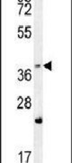 FBXW12 Rabbit anti-Human, Polyclonal, Invitrogen 400 μL; Unconjugated:Antibodies,