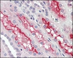 Invitrogen FER Monoclonal Antibody (5D2C4) 100 &mu;L; Unconjugated:Antibodies,