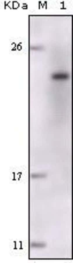 Invitrogen FES Monoclonal Antibody (5A11G5) 100 &mu;L | Buy Online | Invitrogen&trade; | Fisher Scientific