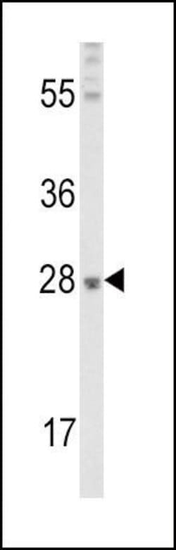 FGF10 Polyclonal Antibody, Invitrogen 400 &mu;L; Unconjugated:Antibodies,