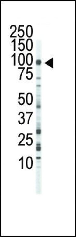 FGFR3 Rabbit anti-Human, Polyclonal, Invitrogen 400 &mu;L; Unconjugated:Antibodies,