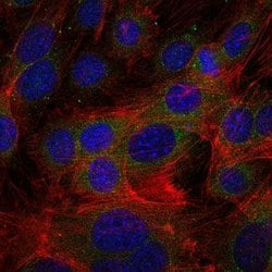 Invitrogen Fibrinogen gamma Monoclonal Antibody (4H9) 100 &mu;L; Unconjugated:Antibodies,