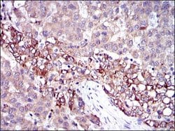 Invitrogen Fibrinogen gamma Monoclonal Antibody (4H9) 100 &mu;L; Unconjugated:Antibodies,
