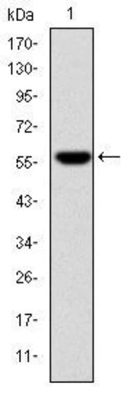 Invitrogen Fibrinogen gamma Monoclonal Antibody (4H9) 100 &mu;L; Unconjugated:Antibodies,