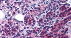 Calcium Sensing Receptor Polyclonal Antibody, Invitrogen 50 &mu;g; Unconjugated:Antibodies,