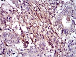 Invitrogen Fibronectin Monoclonal Antibody (2F4) 100 &mu;L; Unconjugated:Antibodies,