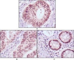 Invitrogen FOXA2 Monoclonal Antibody (7H4B7) 100 &mu;L; Unconjugated:Antibodies,