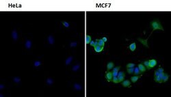 Invitrogen FOXO3A Polyclonal Antibody 100 &mu;g; Unconjugated:Antibodies,