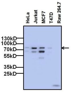 Invitrogen FOXP1 Monoclonal Antibody (6E4C4) 100 &mu;g; Unconjugated:Antibodies,