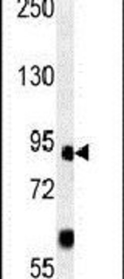 FOXP2 Rabbit anti-Human, Mouse, Polyclonal, Invitrogen 400 &mu;L; Unconjugated:Antibodies,