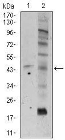 Invitrogen FZD5 Monoclonal Antibody (2D12) 100 &mu;g; Unconjugated:Antibodies,