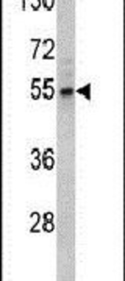 Fascin Rabbit anti-Human, Polyclonal, Invitrogen 400 &mu;L; Unconjugated:Antibodies,
