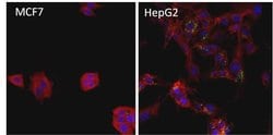 Invitrogen™ Ferritin Monoclonal Antibody (321B7)