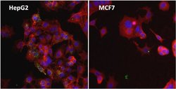 Invitrogen Ferritin Monoclonal Antibody (513C10) 100 &mu;g; Unconjugated:Antibodies,
