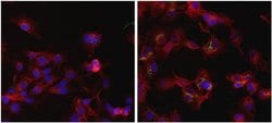 Invitrogen Ferritin Monoclonal Antibody (101) 1 mg; Unconjugated:Antibodies,