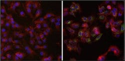 Ferritin Monoclonal Antibody (521), Invitrogen 1 mg; Unconjugated:Antibodies