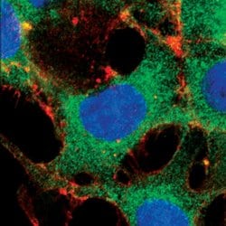 Invitrogen FOXO3A Monoclonal Antibody (K.115.9) 100 &mu;L; Unconjugated:Antibodies,