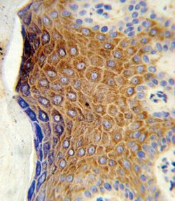 GALNT3 Polyclonal Antibody, Invitrogen 400 &mu;L; Unconjugated:Antibodies,