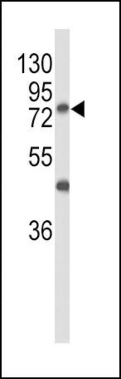 GALNT3 Polyclonal Antibody, Invitrogen 400 &mu;L; Unconjugated:Antibodies,