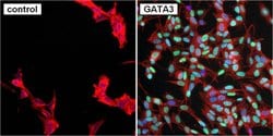 Invitrogen GATA3 Monoclonal Antibody (1A12-1D9) 100 &mu;g; Unconjugated:Antibodies,