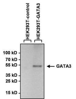 Invitrogen GATA3 Monoclonal Antibody (1A12-1D9) 100 &mu;g; Unconjugated:Antibodies,