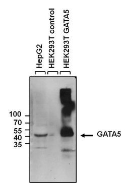 GATA5 Rabbit anti-Human, Polyclonal, Invitrogen 100 &mu;g | Buy Online | Thermo Scientific | Fisher Scientific