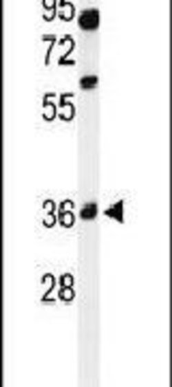 GLT8D2 Rabbit anti-Human, Polyclonal, Invitrogen 400 &mu;L; Unconjugated:Antibodies,