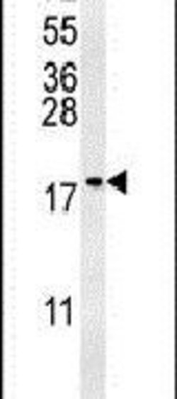 GM2A Polyclonal Antibody, Invitrogen 400 &mu;L; Unconjugated:Antibodies,