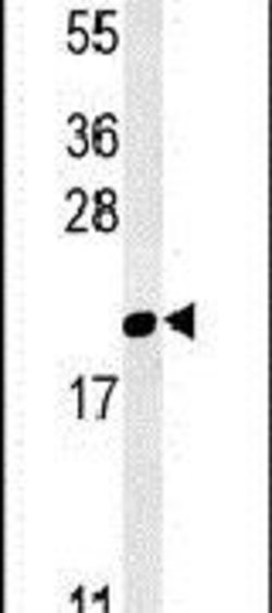 GM2A Polyclonal Antibody, Invitrogen 400 &mu;L; Unconjugated:Antibodies,
