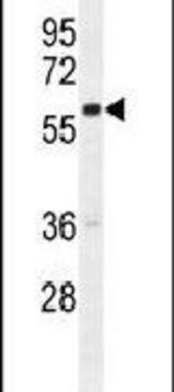 GNL3L Rabbit anti-Human, Polyclonal, Invitrogen 400 &mu;L; Unconjugated:Antibodies,