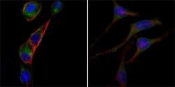 Invitrogen GOT2 Monoclonal Antibody (3E9) 100 &mu;L; Unconjugated:Antibodies,