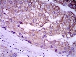 Invitrogen Glypican 3 Monoclonal Antibody (9C2) 100 &mu;g | Buy Online | Invitrogen&trade; | Fisher Scientific