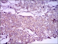 Invitrogen Glypican 3 Monoclonal Antibody (9C2) 100 &mu;g | Buy Online | Invitrogen&trade; | Fisher Scientific