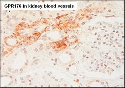 Invitrogen™ GPR176 Polyclonal Antibody