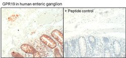 Invitrogen GPR19 Polyclonal Antibody 100 &mu;g; Unconjugated:Antibodies,