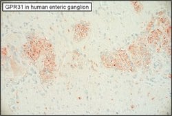 GPR31 Polyclonal Antibody:Antibodies, Polyclonal