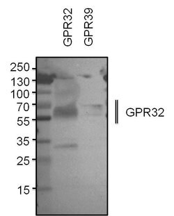 GPR32 Polyclonal Antibody:Antibodies, Polyclonal