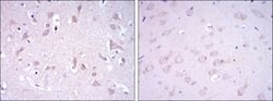 Invitrogen GluR3 Monoclonal Antibody (1D2) 100 &mu;L | Buy Online | Invitrogen&trade; | Fisher Scientific