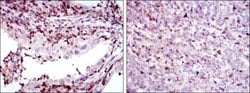 Invitrogen GRK2 Monoclonal Antibody (3F8) 100 &mu;L; Unconjugated:Antibodies,